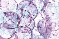 Lila und hellblaue Blasen