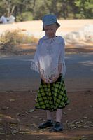 Une jeune fille albinos en Zambie
