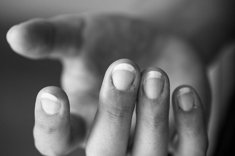 Puur, mijn huid by Catherine Blancquaert