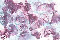 Hellblaue und violette Blasen II