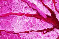 Venen / Venen / Moore / Venen