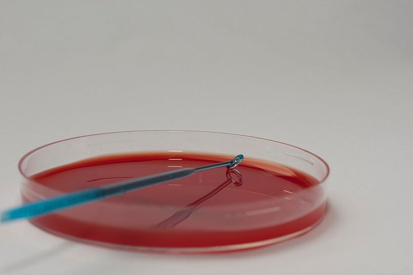 The growth of bacteria in petri dishes by noeky1980 photography
