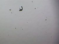 De l'ibuprofène liquide sous un microscope